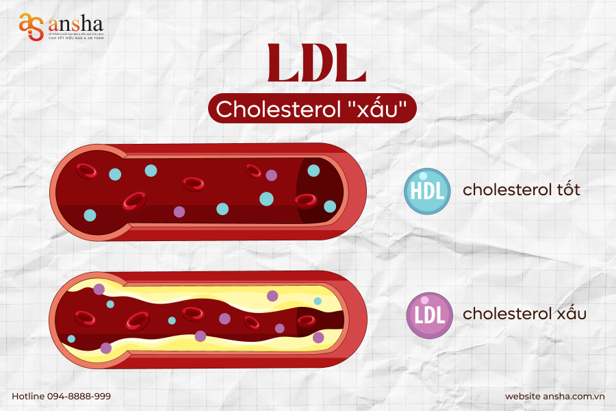 ldl-cholesterol-xau